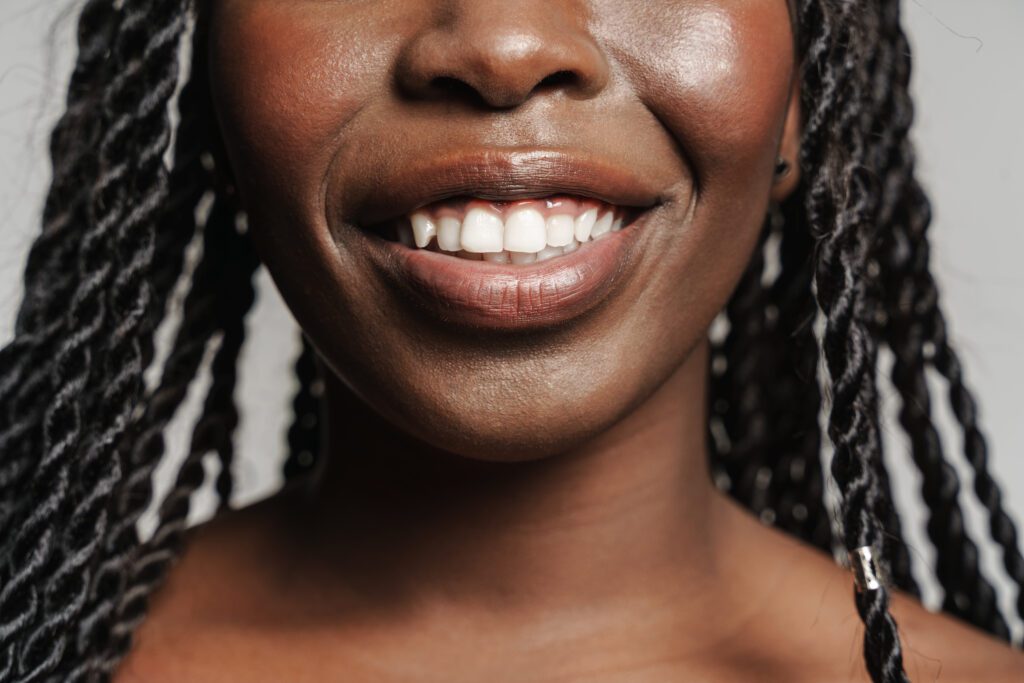 Dark Lips Ou Neutralisation Des Lèvres Fonçées